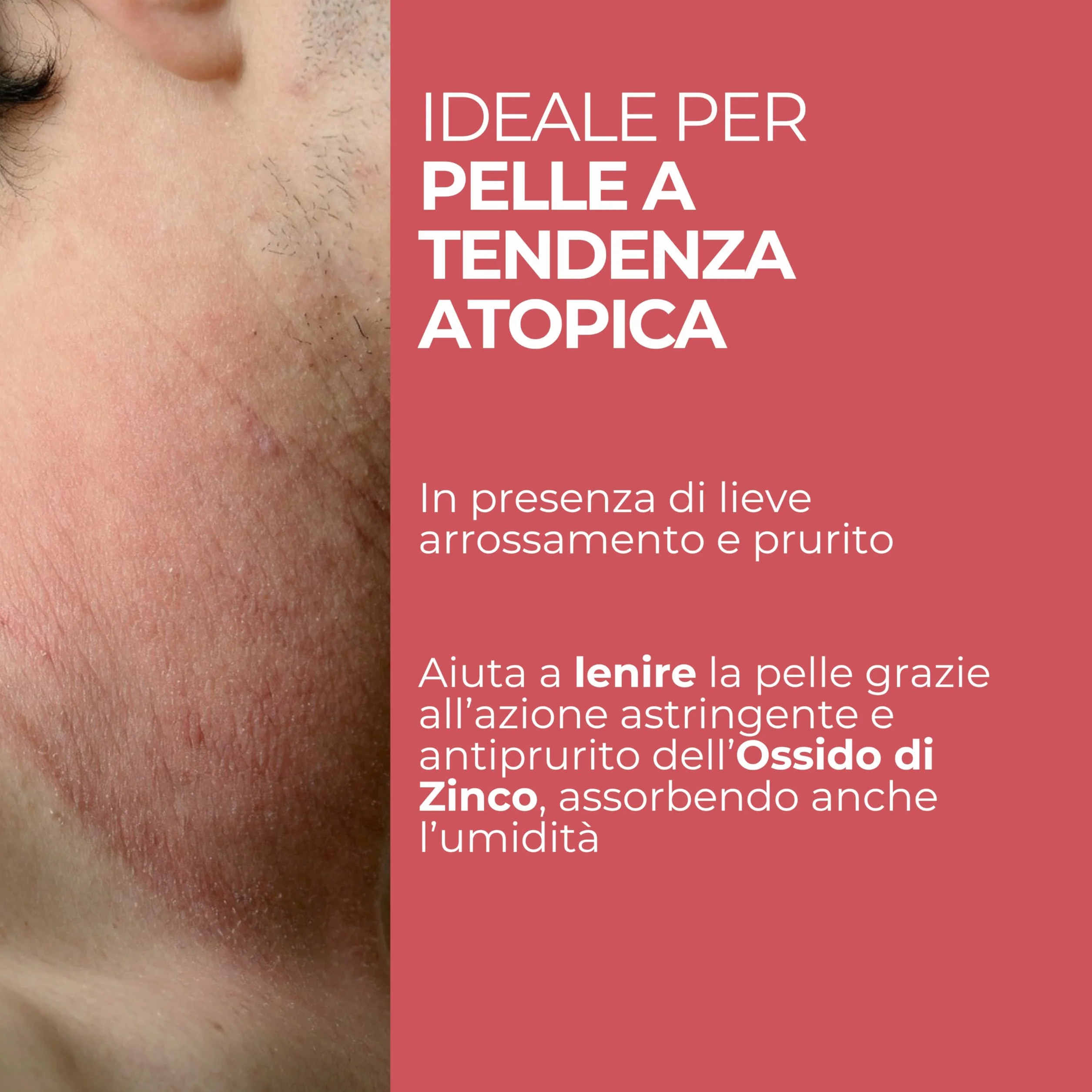 MOST Crema Lenitiva Viso e Corpo 50ml Ossido di Zinco per Pelle Sensibile e Atopica