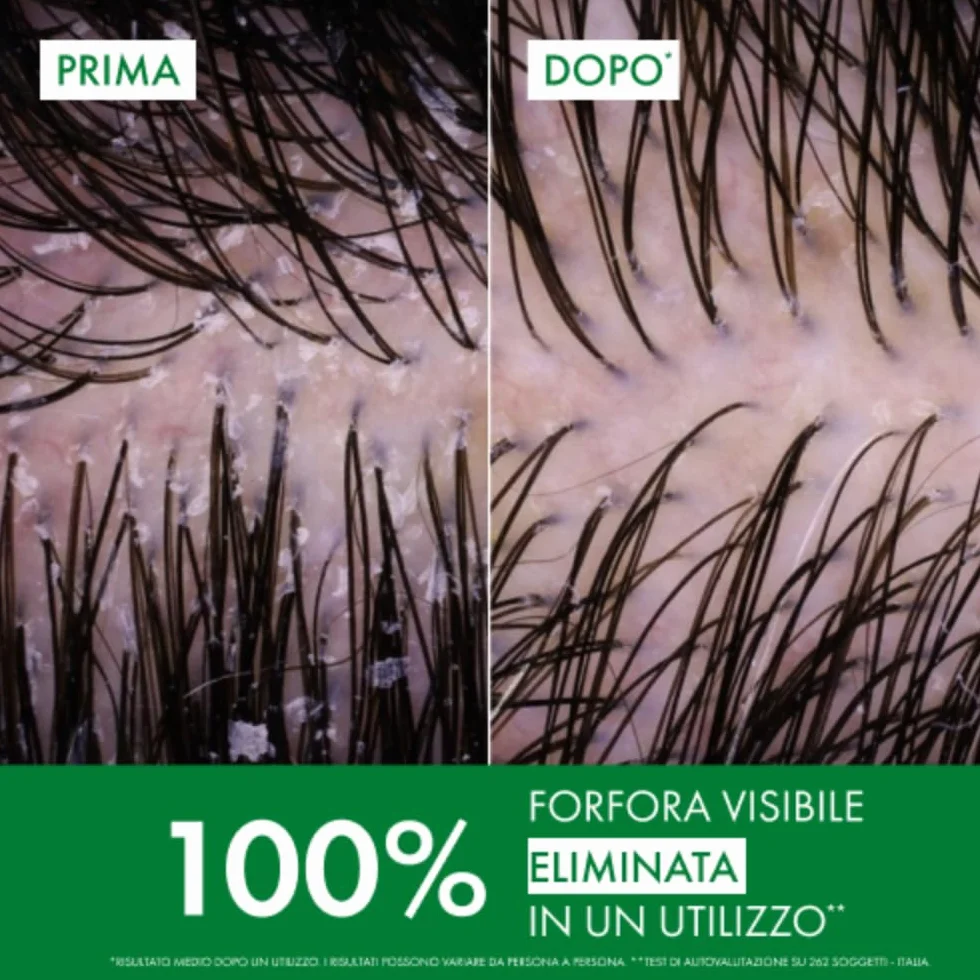 Vichy Dercos Eco-Ricarica Shampoo Anti-Forfora DS per Capelli Secchi, 390 ml