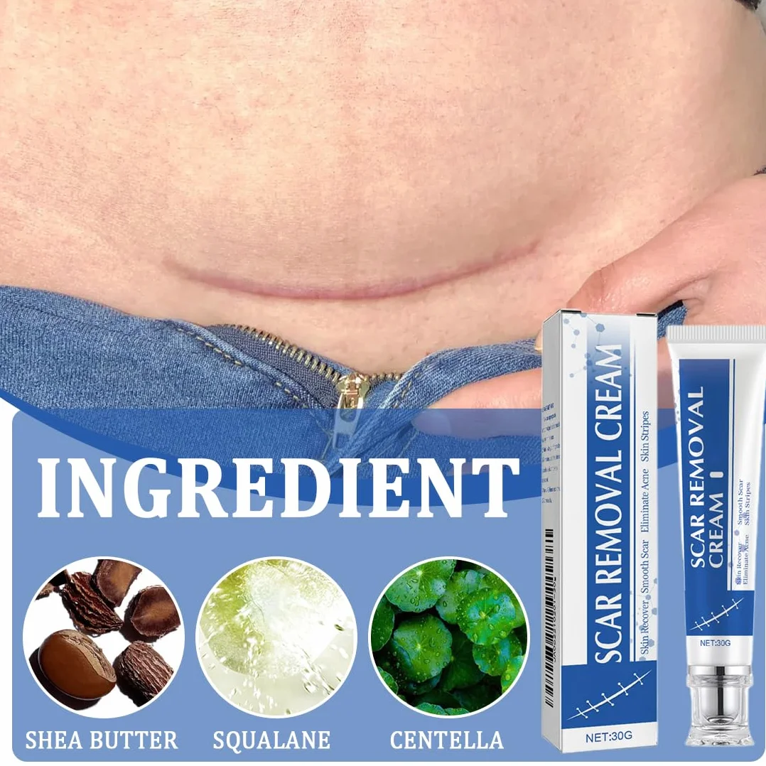 Crema per Cicatrici Sbiadisce le Smagliare 2 Pezzi Ripara Texture Pelle Aspetto Liscio