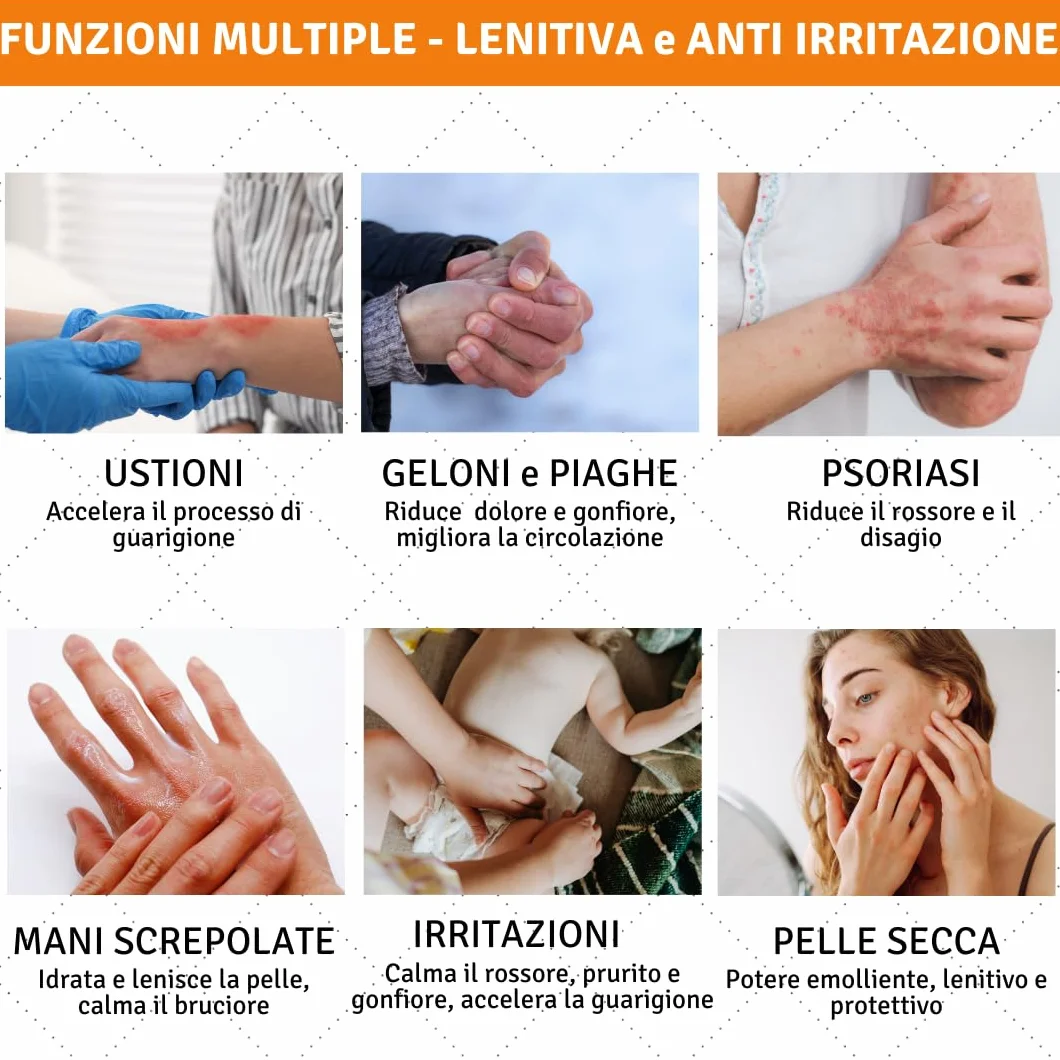 TIS Crema Calendula 100ml Lenitiva Eritemi Scottature Arrossamenti Dermatiti Punture Insetti Ustioni Irritazioni