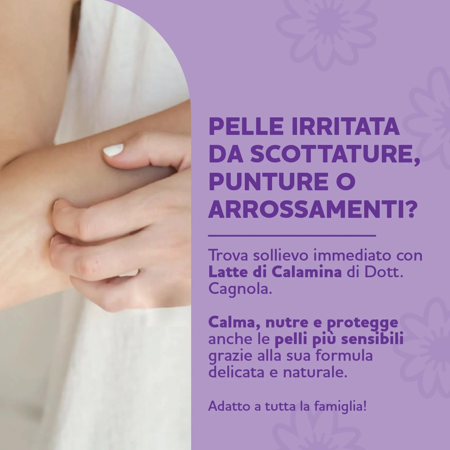 CAGNOLA Crema Fluida Lenitiva Idratante Latte di Calamina 150 ml per Arrossamenti Scottature Punture di Insetto